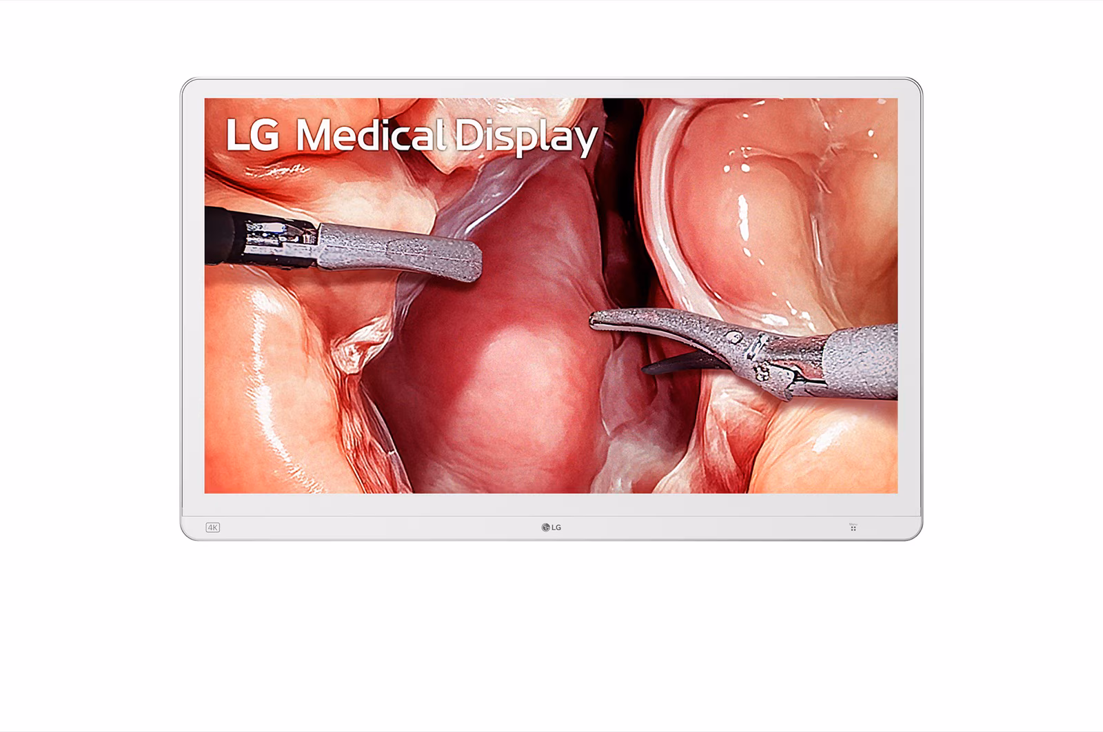 LG 32HS710S 32-inch 4K surgical monitor front view with endoscopic image on screen